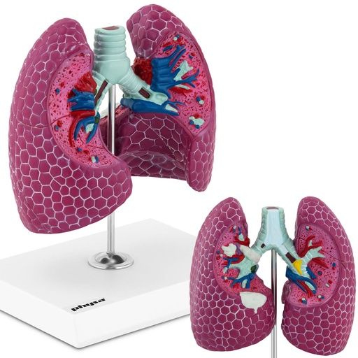 3D anatomical model of the human lung with lesions
